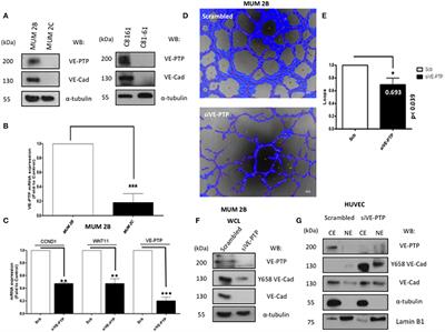 Endothelial Phosphatase VE-PTP Participates in Vasculogenic Mimicry by Preventing Autophagic Degradation of VE-Cadherin